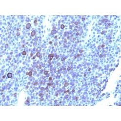 Glypican-3(GPC3/863 + 1G12), CF555 conjugate, 0.1mg/mL