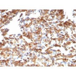 Vimentin(VM1170), CF555 conjugate, 0.1mg/mL