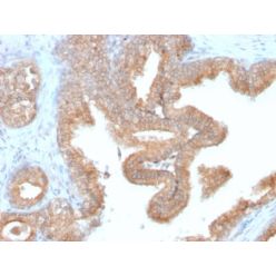 Biotium BNC552748-500, AMACR / p504S (Prostate Cancer Marker) (AMACR/2748R), CF555 conjugate, 0.1mg/mL