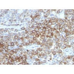 Melanoma Marker(PNL2), CF660R conjugate, 0.1mg/mL