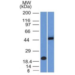 PAX8 (Renal Cell Marker) (PAX8/1492), CF660R conjugate, 0.1mg/mL