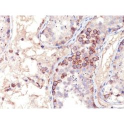 MAGE A1(MA454), CF568 conjugate, 0.1mg/mL