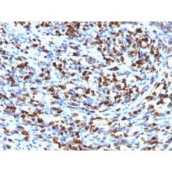 Myogenin(MGN185), CF568 conjugate, 0.1mg/mL