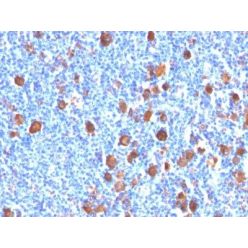 Fascin-1(FSCN1/416), CF568 conjugate, 0.1mg/mL