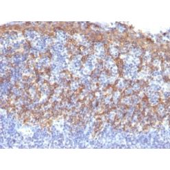 Cytokeratin 14(LL002), CF568 conjugate, 0.1mg/mL