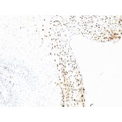 Human Papillomavirus 16 (HPV-16)(CAMVIR-1), CF568 conjugate, 0.1mg/mL