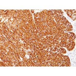 Melanoma Marker(HMB45 + M2-7C10 + M2-9E3 + T311), CF568 conjugate, 0.1mg/mL