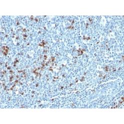 Human Kappa Light Chain(HP6053 + L1C1), CF568 conjugate, 0.1mg/mL
