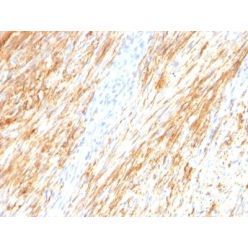 GFAP(ASTRO/789), CF568 conjugate, 0.1mg/mL