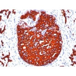 Cytokeratin, pan(KRTL/1077 + KRTH/1076), CF568 conjugate, 0.1mg/mL