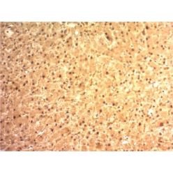 Biotium BNC681125-100, Arginase 1 (Hepatocellular Carcinoma Marker) (ARG1/1125) , CF568 conjugate, 0.1mg/mL