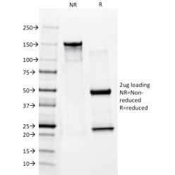 Cytokeratin 10 (Suprabasal Epithelial Marker)(AE20), CF568 conjugate, 0.1mg/mL