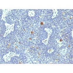 HPV-18 (Human Papilloma Virus 18)(HPV18/1297), CF568 conjugate, 0.1mg/mL