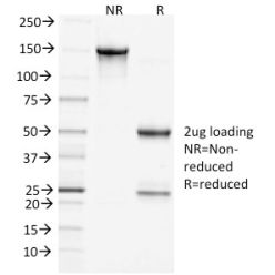 Clathrin, Heavy Chain(CHC/1432), CF568 conjugate, 0.1mg/mL