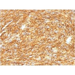 DOG-1 / TMEM16A (Gastrointestinal Stromal Tumor Marker) (DG1/1485), CF568 conjugate, 0.1mg/mL