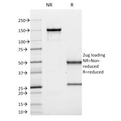 Biotium BNC681620-100, CD10 (Membrane Metalloendopeptidase)(MME/1620), CF568 conjugate, 0.1mg/mL