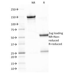 Epstein-Barr Virus (LMP-1)(CS2), CF568 conjugate, 0.1mg/mL