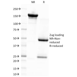 Epstein-Barr Virus (LMP-1)(CS4), CF568 conjugate, 0.1mg/mL