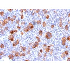 CD30 / TNFRSF8 (Hodgkin &amp; Reed-Sternberg Cell Marker) (rKi-1/779), CF568 conjugate, 0.1mg/mL