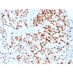 Estrogen Receptor, alpha (Marker of Estrogen Dependence)(ESR1/1904), CF568 conjugate, 0.1mg/mL