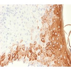 Cytokeratin 10 (Suprabasal Epithelial Marker) (rKRT10/1275), CF568 conjugate, 0.1mg/mL