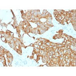Cytokeratin 19 (Pancreatic Stem Cell Marker) (rKRT19/800), CF568 conjugate, 0.1mg/mL