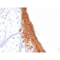 Cytokeratin 10 (KRT10) (Suprabasal Epithelial Marker) (rKRT10/844), CF568 conjugate, 0.1mg/mL
