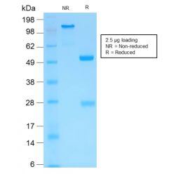 MMP3 (Marker of Metastasis and Rheumatoid Arthritis)(MMP3/1994R), CF568 conjugate, 0.1mg/mL