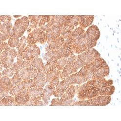 EpCAM / CD326 (Epithelial Marker) (EGP40/2041R), CF568 conjugate, 0.1mg/mL
