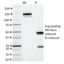IL3RA / CD123 (Acute Myeloid Leukemia Marker) (IL3RA/2065), CF568 conjugate, 0.1mg/mL