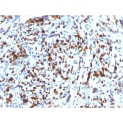 MyoD1 (Rhabdomyosarcoma Marker) (MYOD1/2075R), CF568 conjugate, 0.1mg/mL