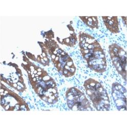 Cytokeratin 8 (KRT8) (rB22.1), CF568 conjugate, 0.1mg/mL