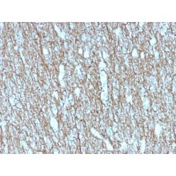 Neurofilament (NF-H) (Neuronal Marker) (rNF421), CF568 conjugate, 0.1mg/mL