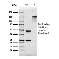 Biotium BNC682364-100, Calbindin 1 (CALB1)(CALB1/2364), CF568 conjugate, 0.1mg/mL