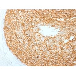 HER-2 / c-erbB-2 / neu / CD340 (ERBB2/2453), CF568 conjugate, 0.1mg/mL