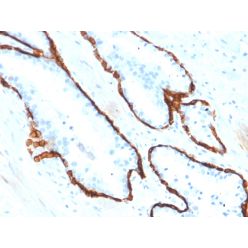 Cytokeratin 15 (Esophageal Squamous Cell Carcinoma Marker)(KRT15/2554), CF568 conjugate, 0.1mg/mL