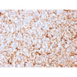 Mammaglobin (SCGB2A2) (Breast Cancer Marker)(MGB1/2682R), CF568 conjugate, 0.1mg/mL