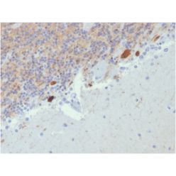 Biotium BNC682807-100, Calretinin / Calbindin 2 (Mesothelioma Marker)(CALB2/2807), CF568 conjugate, 0.1mg/mL