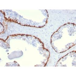 Cytokeratin 15 (Esophageal Squamous Cell Carcinoma Marker)(KRT15/2959), CF568 conjugate, 0.1mg/mL