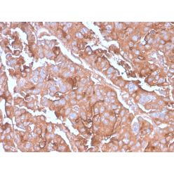 MUC1 / CA15-3 / EMA / CD227 (Epithelial Marker)(MUC1/2980R), CF568 conjugate, 0.1mg/mL