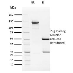 HPV16 E2 (Human Papilloma Virus 16)(TVG 261), CF568 conjugate, 0.1mg/mL
