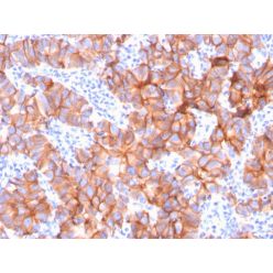 HER-2 / c-erbB-2 / neu / CD340(ERBB2/3079), CF568 conjugate, 0.1mg/mL