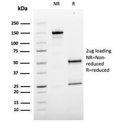MCAM (Melanoma Cell Adhesion Molecule) / MUC18 / CD146(MCAM/3179), CF568 conjugate, 0.1mg/mL