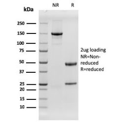 EGFR (Epidermal Growth Factor Receptor)(rGFR/1667), CF568 conjugate, 0.1mg/mL