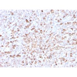 Human Lambda Light Chain (B-Cell Marker)(LLC/3778R), CF568 conjugate, 0.1mg/mL