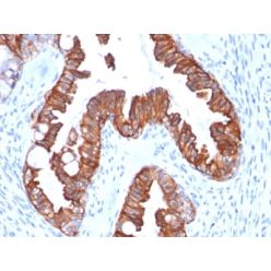 Cytokeratin 7 (Glandular and Transitional Epithelial Marker) (rOV-TL12/30), CF770 conjugate, 0.1mg/mL