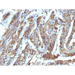 Calponin-1 (Smooth Muscle Marker), CF740 conjugate, 0.1mg/mL