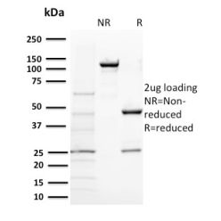 BAP1 (BRCA1 Associated Protein 1)(BAP1/2431), CF740 conjugate, 0.1mg/mL