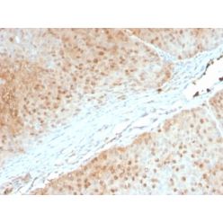 AKT1 (Prognostic Marker for Neuroendocrine Tumors) (AKT1/2552), CF740 conjugate, 0.1mg/mL