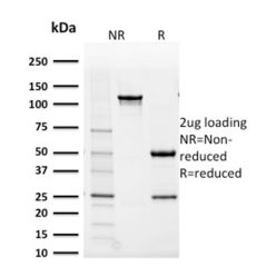 Aldo-keto Reductase Family 1 Member B1 (Adrenal Marker)(CPTC-AKR1B1-2), CF740 conjugate, 0.1mg/mL